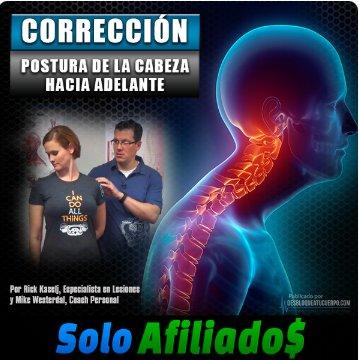 Corrección de la Postura de la Cabeza Hacia Adelante